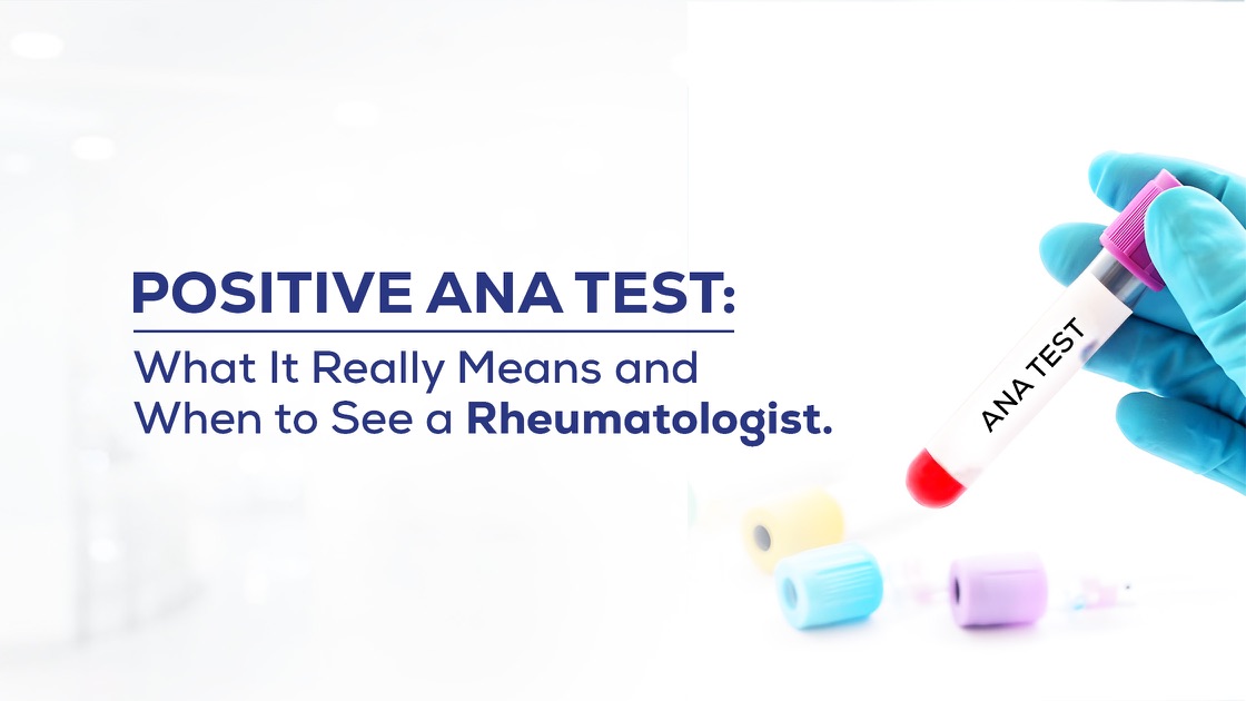 Blog banner for AXIS