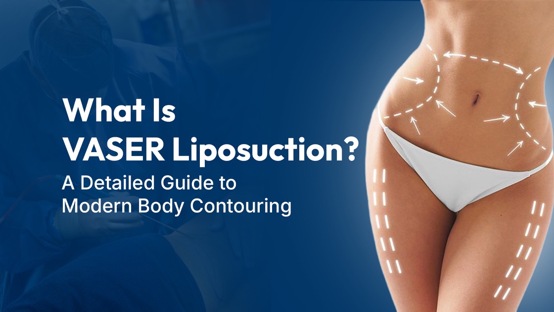 Blog banner for LipoRefine